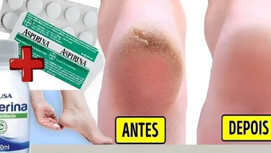 Hidratante caseiro para pés rachados que deixa os pés super lisos e macios