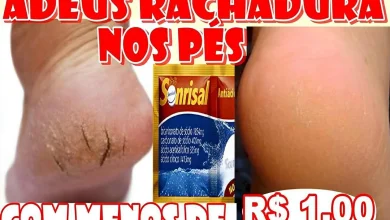 Como acabar com as rachaduras dos pés com uma misturinha caseira muito fácil de fazer